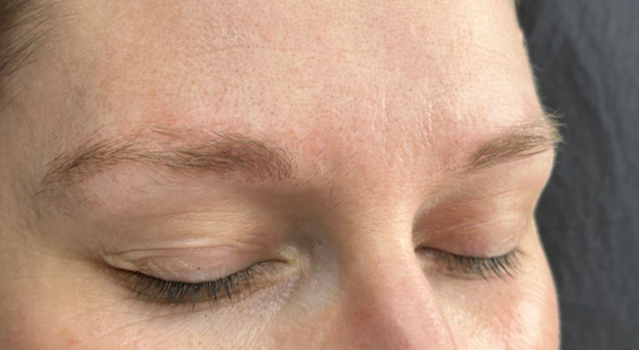 Before image