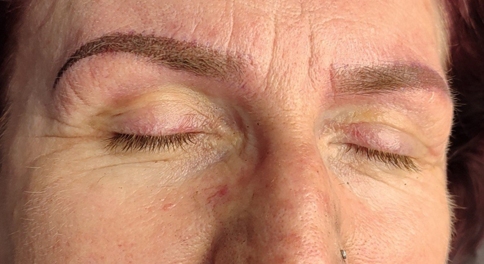After image
