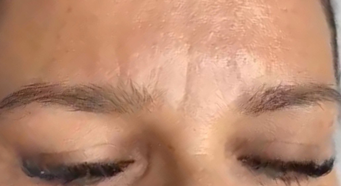 Before image